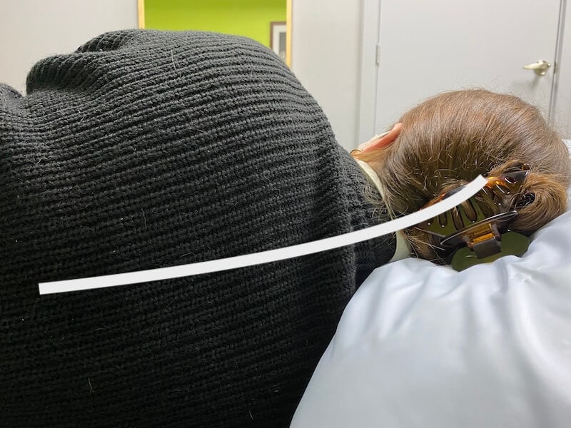 Effect on neck if pillow is too high - Adelaide West Physio + Pilates - Headache Clinic
