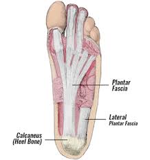 Plantar Fasciitis - Or Is It? plantar fascia plantar fasciitis
