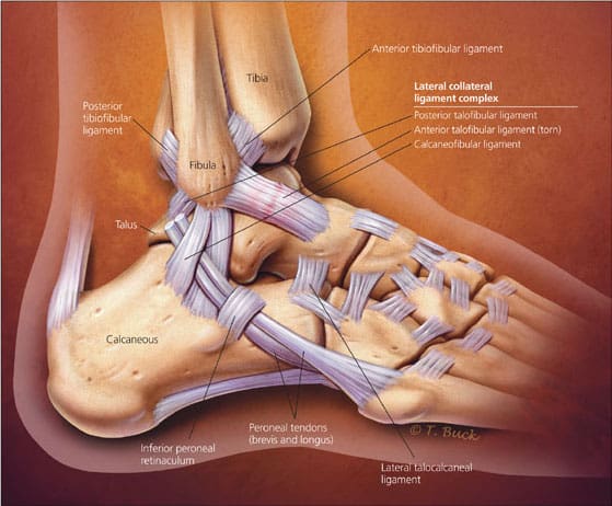 Lateral ankle ligament anatomy - Adelaide West Physio + Pilates | Headache Clinic