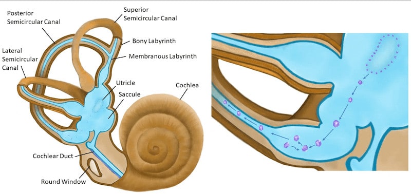 How crystals can migrate into the semicircular canal - Adelaide West Physio + Headache Clinic