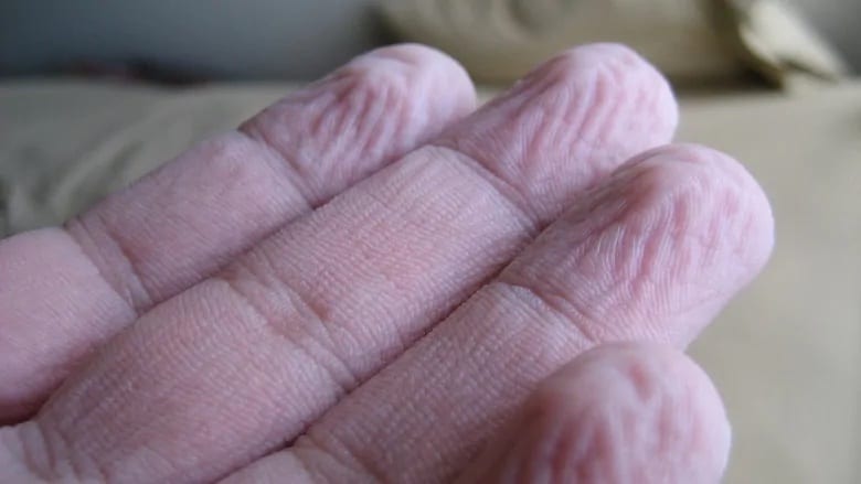 The reason behind wrinkly pruney fingers is very interesting
