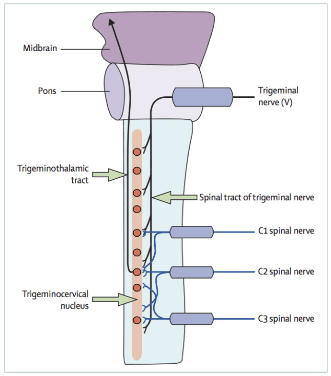 diagram showing upper-neck and head sensory signals meeting in the trigeminocervical nucleus