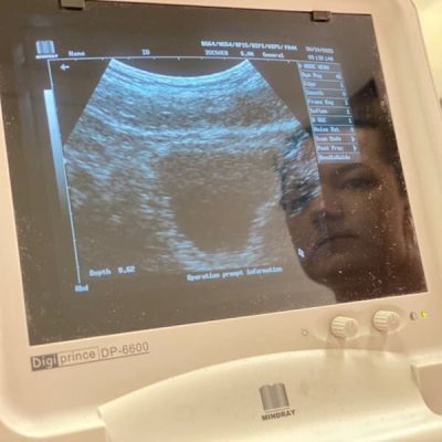 lisa performing a real time ultrasound assessment of the pelvic floor