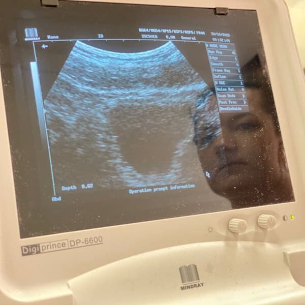 lisa performing a real time ultrasound assessment of the pelvic floor