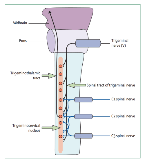 trigeminocervical nucleus is important in all headache migraine neck pain